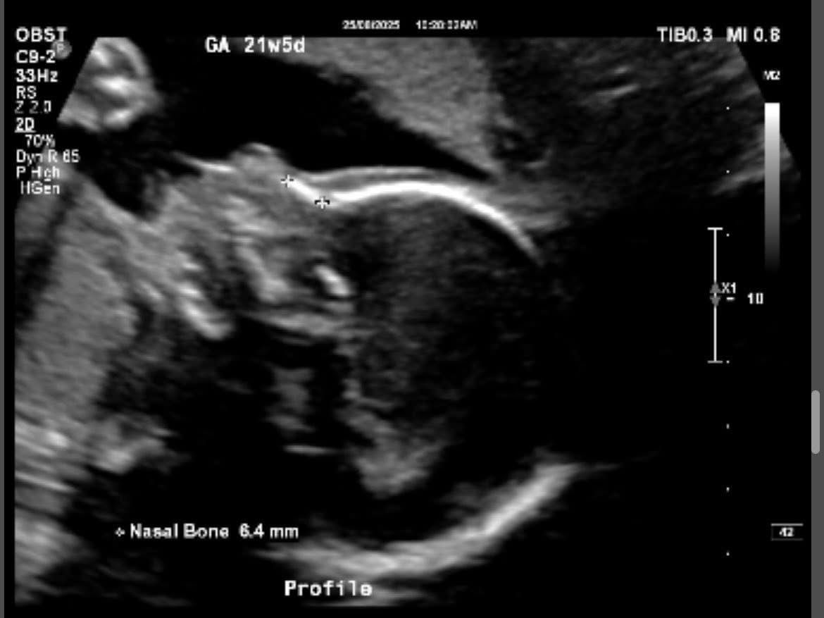 Baby Naomie’s Essentials Fund 💕